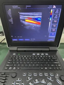 E20 Портативный ультразвуковой сканер Цветные допплеровские аппараты для беременных